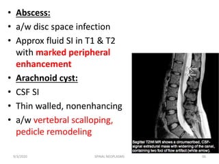 Neoplastic disorders of spinal cord | PPTX