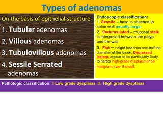 Types of adenomas
On the basis of epithelial structure

1. Tubular adenomas
2. Villous adenomas
3. Tubulovillous adenomas
4. Sessile Serrated
adenomas

Endoscopic classification:
1. Sessile – base is attached to
colon wall usually large
2. Pedunculated – mucosal stalk
is interposed between the polyp
and the wall
3. Flat – height less than one-half the
diameter of the lesion. Depressed
lesions appear to be particularly likely
to harbor high-grade dysplasia or be
malignant even if small.

Pathologic classification: I. Low grade dysplasia II. High grade dysplasia

 