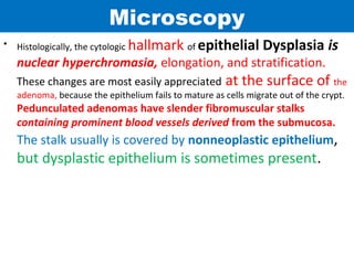 Microscopy
•

Histologically, the cytologic

hallmark of epithelial Dysplasia is

nuclear hyperchromasia, elongation, and stratification.
These changes are most easily appreciated

at the surface of the

adenoma, because the epithelium fails to mature as cells migrate out of the crypt.

Pedunculated adenomas have slender fibromuscular stalks
containing prominent blood vessels derived from the submucosa.

The stalk usually is covered by nonneoplastic epithelium,

but dysplastic epithelium is sometimes present.

 