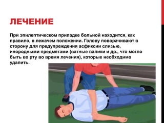 ЛЕЧЕНИЕ
При эпилептическом припадке больной находится, как
правило, в лежачем положении. Голову поворачивают в
сторону для предупреждения асфиксии слизью,
инородными предметами (ватные валики и др., что могло
быть во рту во время лечения), которые необходимо
удалить.
 