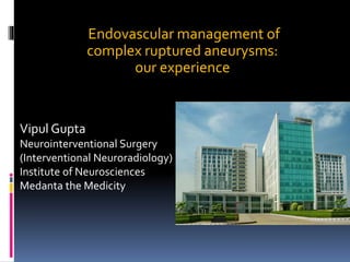 Endovascular management of
complex ruptured aneurysms:
our experience
Vipul Gupta
Neurointerventional Surgery
(Interventional Neuroradiology)
Institute of Neurosciences
Medanta the Medicity
 