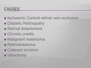 CAUSES
Ischaemic Central retinal vein occlusion
 Diabetic Retinopathy
 Retinal detachment
 Chronic uveitis
 Malignant melanoma
 Retinoblastoma
 Cataract excision
 Vitrectomy


 