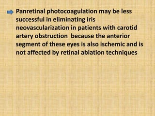 • Panretinal photocoagulation may be less
successful in eliminating iris
neovascularization in patients with carotid
artery obstruction because the anterior
segment of these eyes is also ischemic and is
not affected by retinal ablation techniques
 