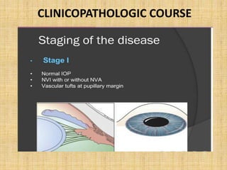 CLINICOPATHOLOGIC COURSE
 
