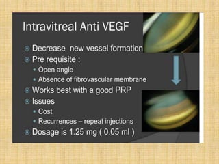 Neovascular glaucoma