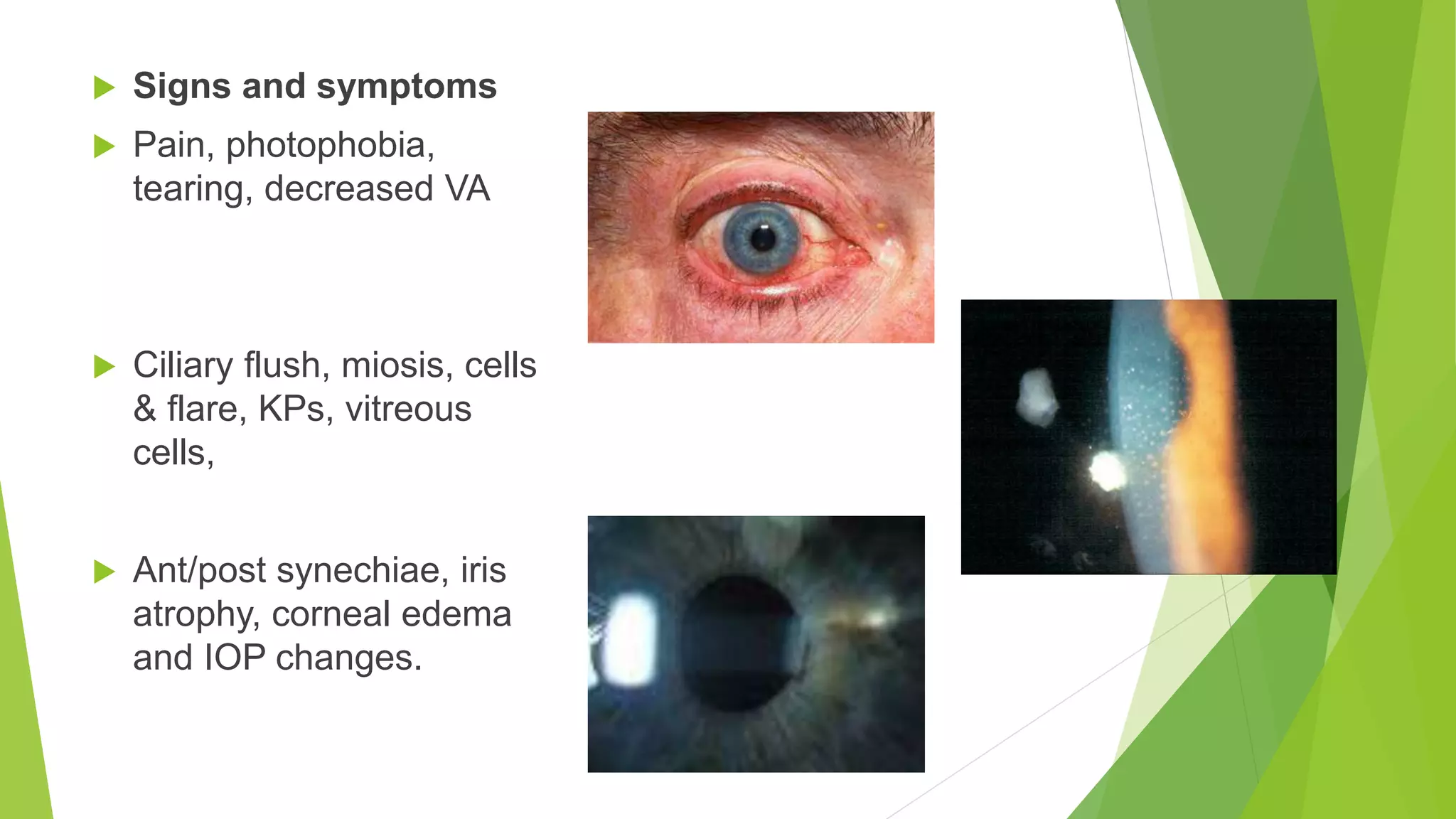  Signs and symptoms
 Pain, photophobia,
tearing, decreased VA
 Ciliary flush, miosis, cells
& flare, KPs, vitreous
cells,
 Ant/post synechiae, iris
atrophy, corneal edema
and IOP changes.
 