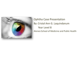 Ophtha Case Presentation By: Cristal Ann G. Laquindanum        Year Level 8  Ateneo School of Medicine and Public Health 