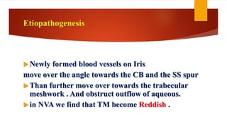 Etiopathogenesis
Newly formed blood vessels on Iris
move over the angle towards the CB and the SS spur
Than further move over towards the trabecular
meshwork . And obstruct outflow of aqueous.
in NVA we find that TM become Reddish .
 