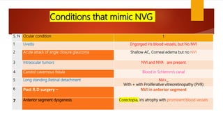 Conditions that mimic NVG
S. N Ocular condition t
1 Uveitis Engorged iris blood vessels, but No NVI
2 Acute attack of angle closure glaucoma Shallow AC, Corneal edema but no NVI
3 Intraocular tumors NVI and NVA are present
4 Carotid-cavernous fistula Blood in Schlemm’s canal
5 Long standing Retinal detachment NV+_
With + with Proliferative vitreoretinopathy (PVR)
6 Post R.D surgery – NVI in anterior segment
7 Anterior segment dysgenesis Corectopia, iris atrophy with prominent blood vessels
 