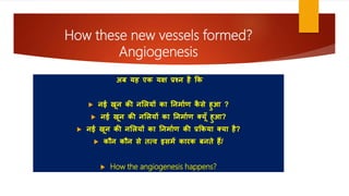 How these new vessels formed?
Angiogenesis
अब यह एक यक्ष प्रश्न है कक
 नई खून की नलियों का ननर्ााण क
ै से हुआ ?
 नई खून की नलियों का ननर्ााण कयूूँ हुआ?
 नई खून की नलियों का ननर्ााण की प्रककया कया है?
 कौन कौन से तत्व इसर्ें कारक बनते हैं/
 How the angiogenesis happens?
 
