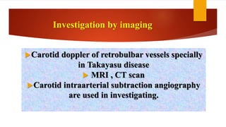 Investigation by imaging
Carotid doppler of retrobulbar vessels specially
in Takayasu disease
 MRI , CT scan
Carotid intraarterial subtraction angiography
are used in investigating.
 
