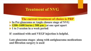 The current treatment of choice is PRP
 In Pre glaucoma or Angle closure stage of NVG
 1200–1600 burns ( 500 µm ) at one spot apart
 1 to 3 session in a week period.
If combined with anti VEGF injection is helpful.
Late glaucoma stages along with antiglaucoma medications
and filtration surgery is used
Treatment of NVG
 