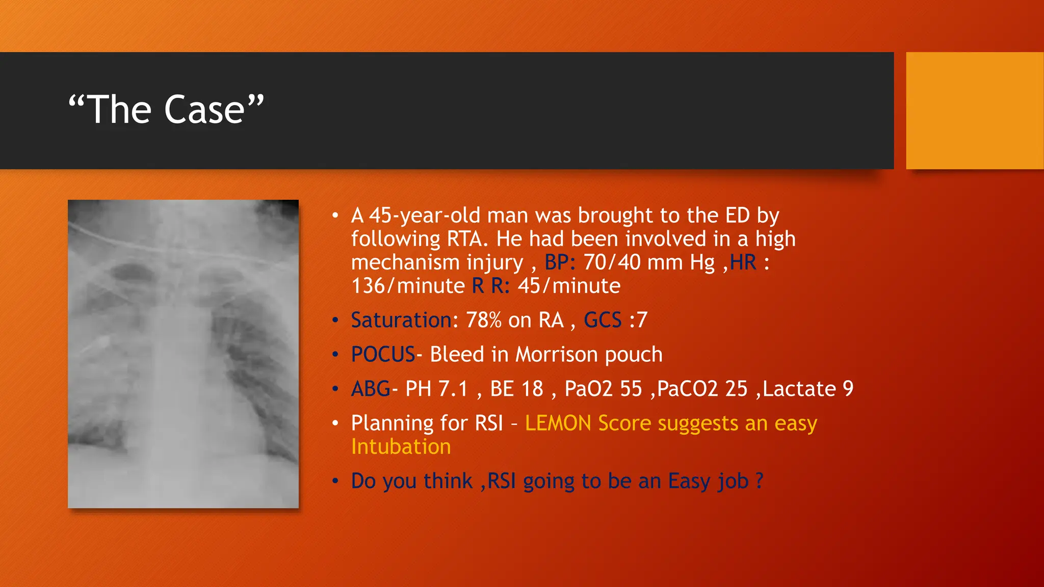 Difficult Airway in Polytrauma.pptx