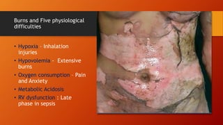 Burns and Five physiological
difficulties
• Hypoxia – Inhalation
injuries
• Hypovolemia - Extensive
burns
• Oxygen consumption – Pain
and Anxiety
• Metabolic Acidosis
• RV dysfunction : Late
phase in sepsis
 