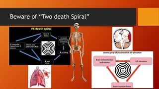 Beware of “Two death Spiral”
 