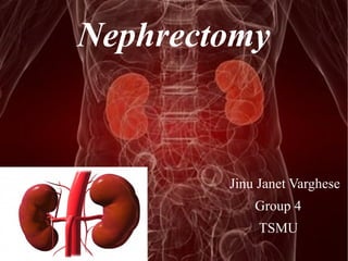 Nephrectomy 
Jinu Janet Varghese 
Group 4 
TSMU 
 