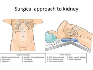 Surgical approach to kidney
 