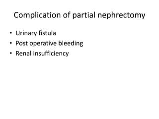 Complication of partial nephrectomy
• Urinary fistula
• Post operative bleeding
• Renal insufficiency
 