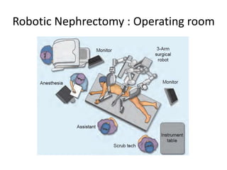 Robotic Nephrectomy : Operating room
 