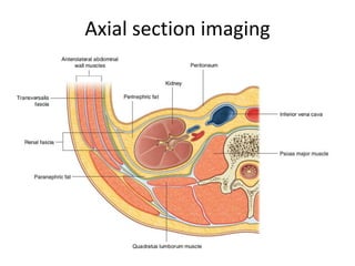 Axial section imaging
 