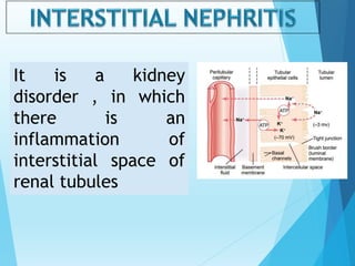 It is a kidney
disorder , in which
there is an
inflammation of
interstitial space of
renal tubules
 