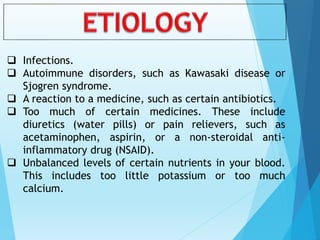  Infections.
 Autoimmune disorders, such as Kawasaki disease or
Sjogren syndrome.
 A reaction to a medicine, such as certain antibiotics.
 Too much of certain medicines. These include
diuretics (water pills) or pain relievers, such as
acetaminophen, aspirin, or a non-steroidal anti-
inflammatory drug (NSAID).
 Unbalanced levels of certain nutrients in your blood.
This includes too little potassium or too much
calcium.
 