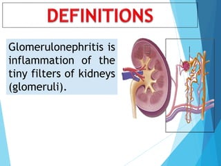 Glomerulonephritis is
inflammation of the
tiny filters of kidneys
(glomeruli).
 