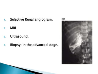 4. Selective Renal angiogram.
5. MRI
6. Ultrasound.
7. Biopsy: In the advanced stage.
 