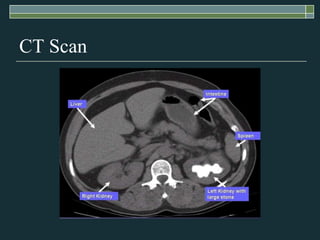CT Scan