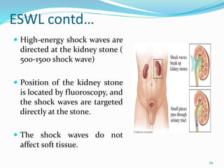 ESWL contd…
 High-energy shock waves are
directed at the kidney stone (
500-1500 shock wave)
 Position of the kidney stone
is located by fluoroscopy, and
the shock waves are targeted
directly at the stone.
 The shock waves do not
affect soft tissue.
29
 