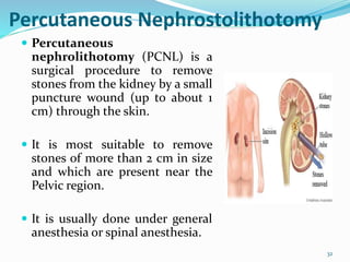 Percutaneous Nephrostolithotomy
 Percutaneous
nephrolithotomy (PCNL) is a
surgical procedure to remove
stones from the kidney by a small
puncture wound (up to about 1
cm) through the skin.
 It is most suitable to remove
stones of more than 2 cm in size
and which are present near the
Pelvic region.
 It is usually done under general
anesthesia or spinal anesthesia.
32
 