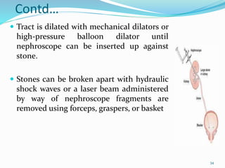 Contd…
 Tract is dilated with mechanical dilators or
high-pressure balloon dilator until
nephroscope can be inserted up against
stone.
 Stones can be broken apart with hydraulic
shock waves or a laser beam administered
by way of nephroscope fragments are
removed using forceps, graspers, or basket
34
 