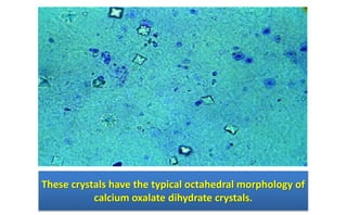 These crystals have the typical octahedral morphology of
calcium oxalate dihydrate crystals.
 