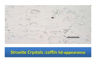 Struvite Crystals :coffin lid-appearance
 