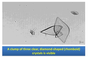 A clump of three clear, diamond-shaped (rhomboid)
crystals is visible
 
