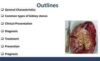Outlines
 General Characteristics
 Common types of kidney stones
 Clinical Presentation
 Diagnosis
 Treatment
 Prevention
 Prognosis
 