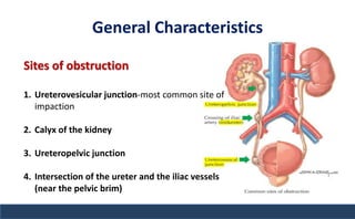 General Characteristics
Sites of obstruction
1. Ureterovesicular junction-most common site of
impaction
2. Calyx of the kidney
3. Ureteropelvic junction
4. Intersection of the ureter and the iliac vessels
(near the pelvic brim)
 