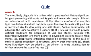Quiz
Answer D.
The most likely diagnosis in a patient with a past medical history significant
for gout presenting with acute colicky pain and hematuria is nephrolithiasis
secondary to uric acid renal stones. Unlike other types of renal stones, this
type is radiolucent and will not show up on X-ray (A). Patients with gout are
at increased risk for developing uric acid stones. Sodium bicarbonate will
alkalinize the urine to achieve a urinary pH of 6–6.5, as this would provide
optimal conditions for dissolution of uric acid stones. Patients with
hyperparathyroidism are more prone to developing calcium oxalate renal
stones (B). Suppressive antibiotics should be considered in the case of
struvite stones secondary to recurrent urinary tract infections (E). Shock
wave lithotripsy may be added as an adjunct to urine alkalinization to
further improve the stone-free rate (C).
 