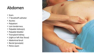 Abdomen
• Scars
• ? Tenckhoff catheter
• Ascites
• Palpation:
• Loin tenderness
• Palpable kidney(s)
• Palpable bladder
• Transplant kidney
• (right or left iliac fossa)
• Abdominal bruit
• Rectal (prostate)
• Pelvic exam
 