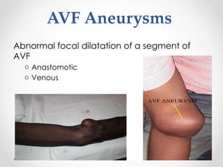Comprehensive Guide to Vascular Access for Dialysis Nurses: Techniques ...