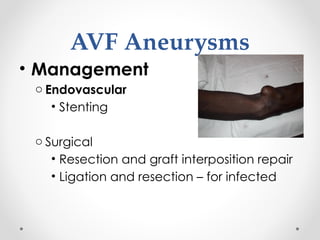 Resection Avf Comprehensive Guide to Vascular Access for Dialysis Nurses: Techniques ...