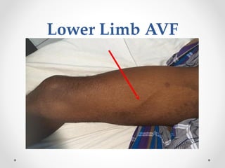 Comprehensive Guide to Vascular Access for Dialysis Nurses: Techniques ...