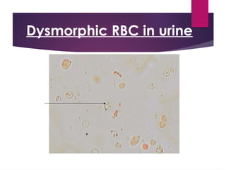 Nephrology in Images presentation of nephro | PPTX
