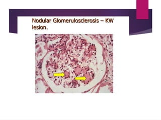 Nephrology in Images presentation of nephro | PPTX