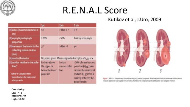 Nephrometry