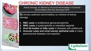 CHRONIC KIDNEY DISEASE
D) Urinary sediment abnormalities as markers of kidney
damage
1. RBC casts in proliferative glomerulonephritis
2. WBC casts in pyelonephritis or interstitial nephritis
3. Oval fat bodies or fatty casts in diseases with proteinuria
4. Granular casts and renal tubular epithelial cells in many
parenchymal diseases (non-specific)
Kidney damage, as defined by structural abnormalities or functional
abnormalities other than decreased GFR
 