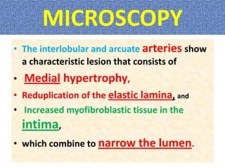 MICROSCOPY
• The interlobular and arcuate arteries show
a characteristic lesion that consists of
• Medial hypertrophy,
• Reduplication of the elastic lamina, and
• Increased myofibroblastic tissue in the
intima,
• which combine to narrow the lumen.
 