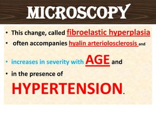 MICROSCOPY
• This change, called fibroelastic hyperplasia
• often accompanies hyalin arteriolosclerosis and
• increases in severity with AGEand
• in the presence of
HYPERTENSION.
 