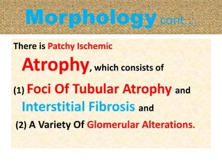 Morphology cont….
There is Patchy Ischemic
Atrophy, which consists of
(1) Foci Of Tubular Atrophy and
Interstitial Fibrosis and
(2) A Variety Of Glomerular Alterations.
 