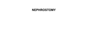 Nephrostomy Tubes
NEPHROSTOMY
 